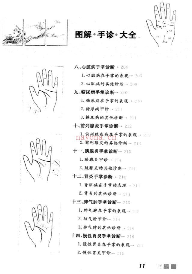雷子张家林图解手诊大全319页PDF 手诊医学教程
