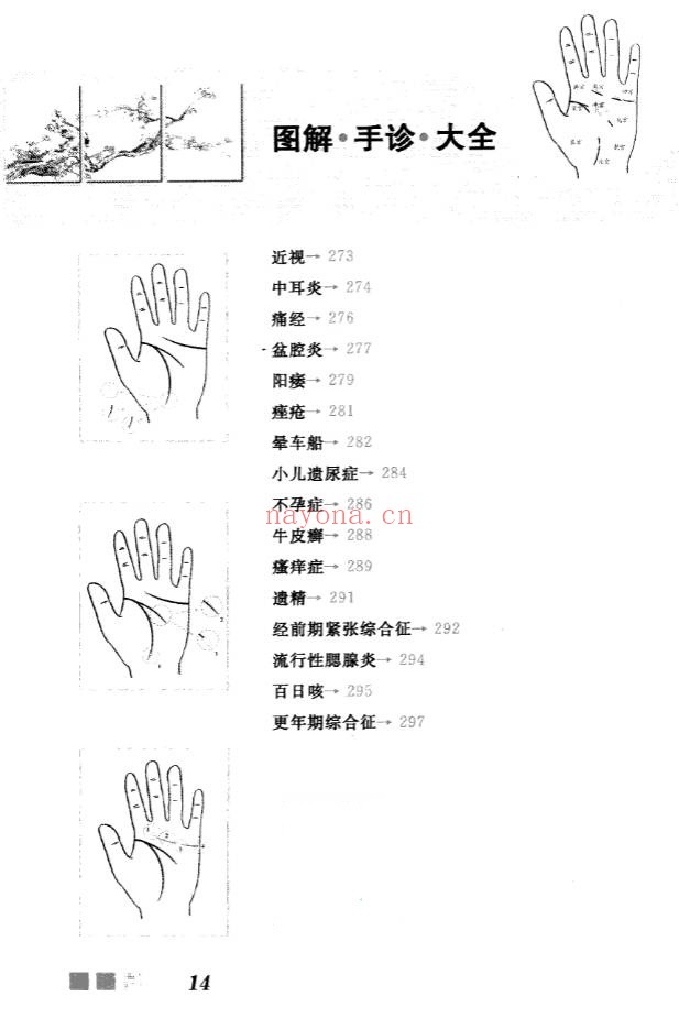 雷子张家林图解手诊大全319页PDF 手诊医学教程