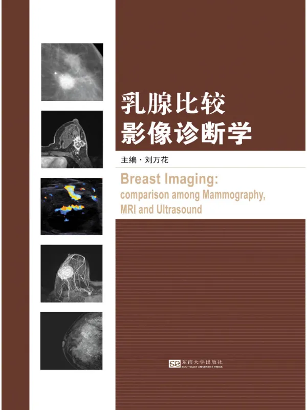 《乳腺比较影像诊断学》刘万花【文字版_PDF电子书_】 《乳腺比较影像诊断学》封面图片
