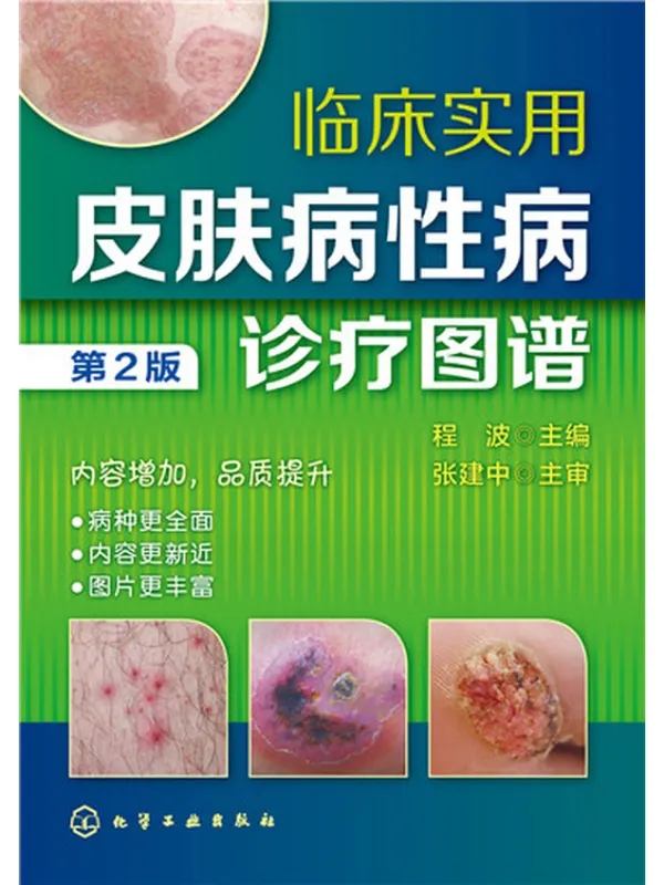 《临床实用皮肤病性病诊疗图谱 第2版》程波【文字版_PDF电子书_】 《临床实用皮肤病性病诊疗图谱 第2版》封面图片