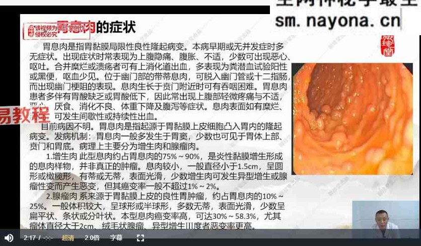 都氏蒙医震疗术 视频8集