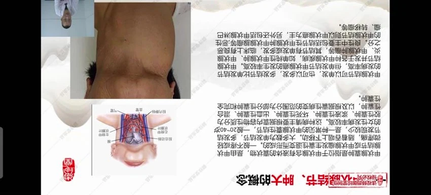 《都氏蒙医震疗术》视频8集