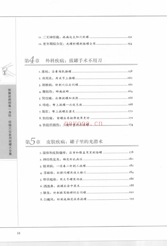 图解拔病排毒一身轻 经络穴位家用拔罐大全集pdf