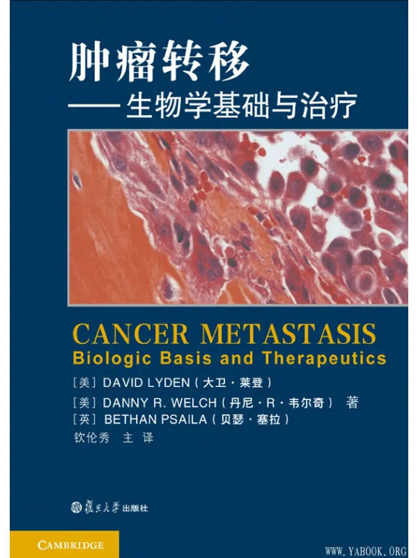 《肿瘤转移：生物学基础与治疗》封面图片