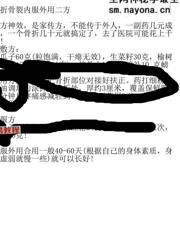 骨折骨裂蜜方两套pdf