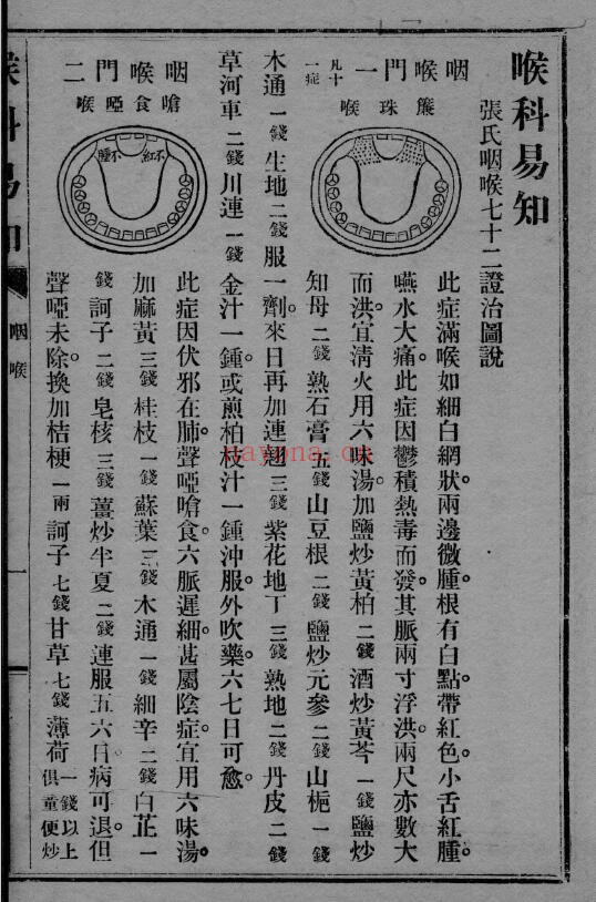 《喉科易知》62页 中医 第2张-古籍汇典 《喉科易知》62页 中医 第2张