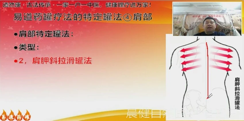 《易道药罐53节课》视频53集