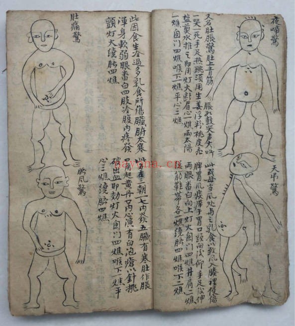 道医治症秘方手抄本140单面PDF 道医秘方