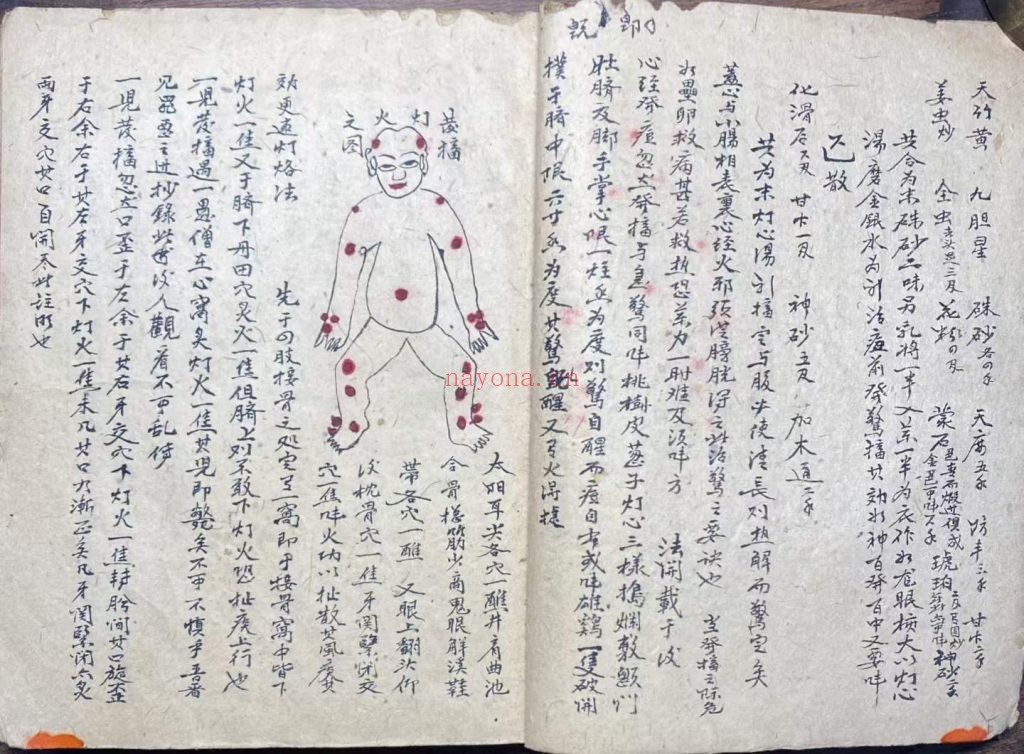 《妙手生春医门广单》10
