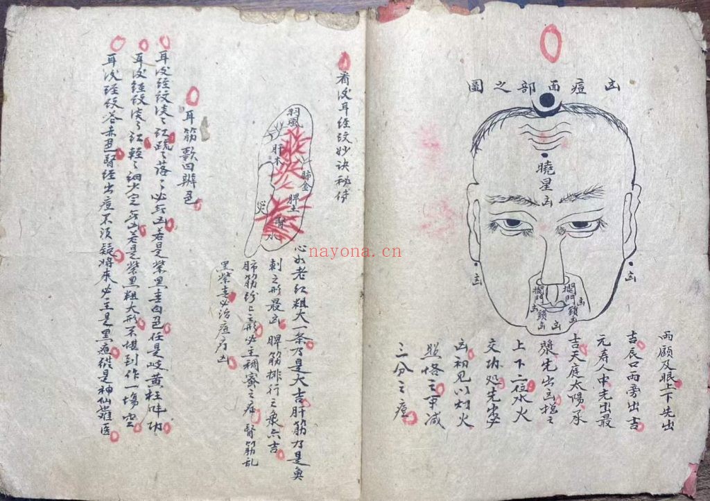 《妙手生春医门广单》10