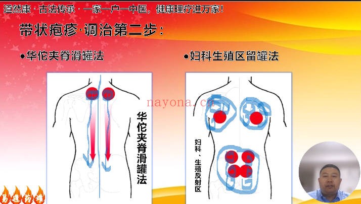 易道药罐疗法53集视频 中医外治法