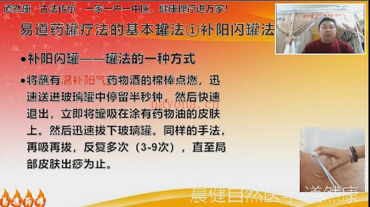 易道药罐疗法53集视频 中医外治法