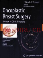 ONCOPLASTIC BREAST SURGERY A GUIDE TO CLINICAL PRACTICE