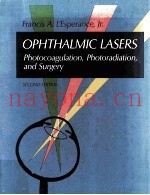 Ophthalmic Lasers