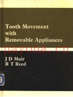 Tooth Movement with Removable Appliances