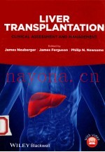 LIVER TRANSPLANTATION CLINICAL ASSESSMENT AND MANAGEMENT