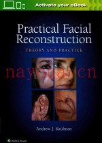 PRACTICAL FACIAL RECONSTRUCTION THEORY AND PRACTICE