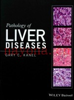 PATHOLOGY OF LIVER DISEASES