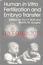 HUMAN IN VITRO FERTILIZATION AND EMBRYO TRANSFER