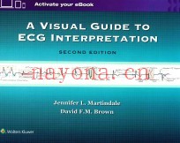 A VISUAL GUIDE TO ECG INTERPRETATION SECOND EDITION