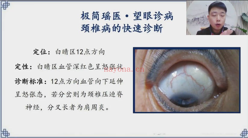 李均峰瑶医天象眼诊十大高发疾病诊断12集视频 瑶医教程