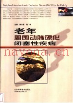 老年周围动脉硬化闭塞性疾病