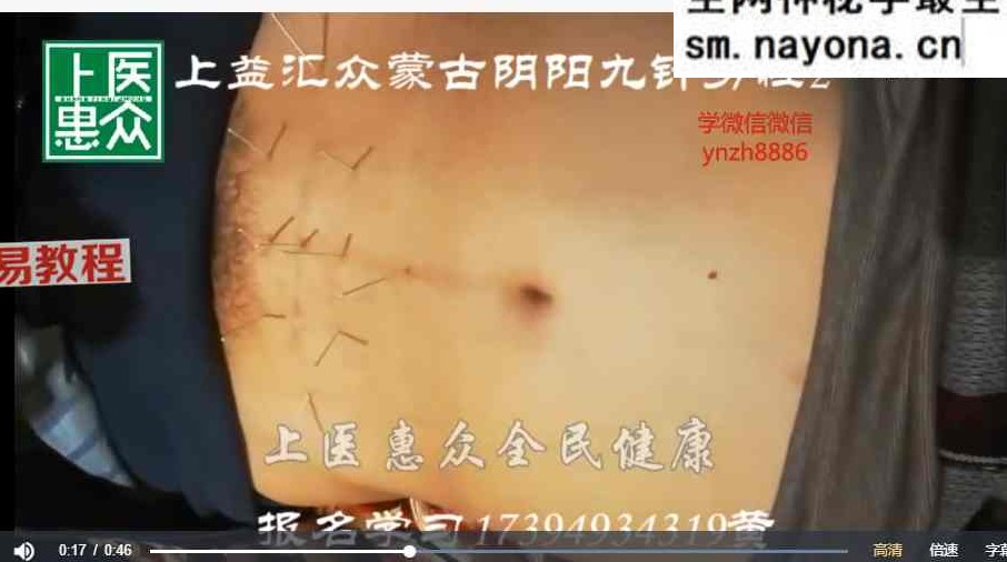 蒙医祖传手法针灸线下培训录制视频-往期学员复习区 视频43集