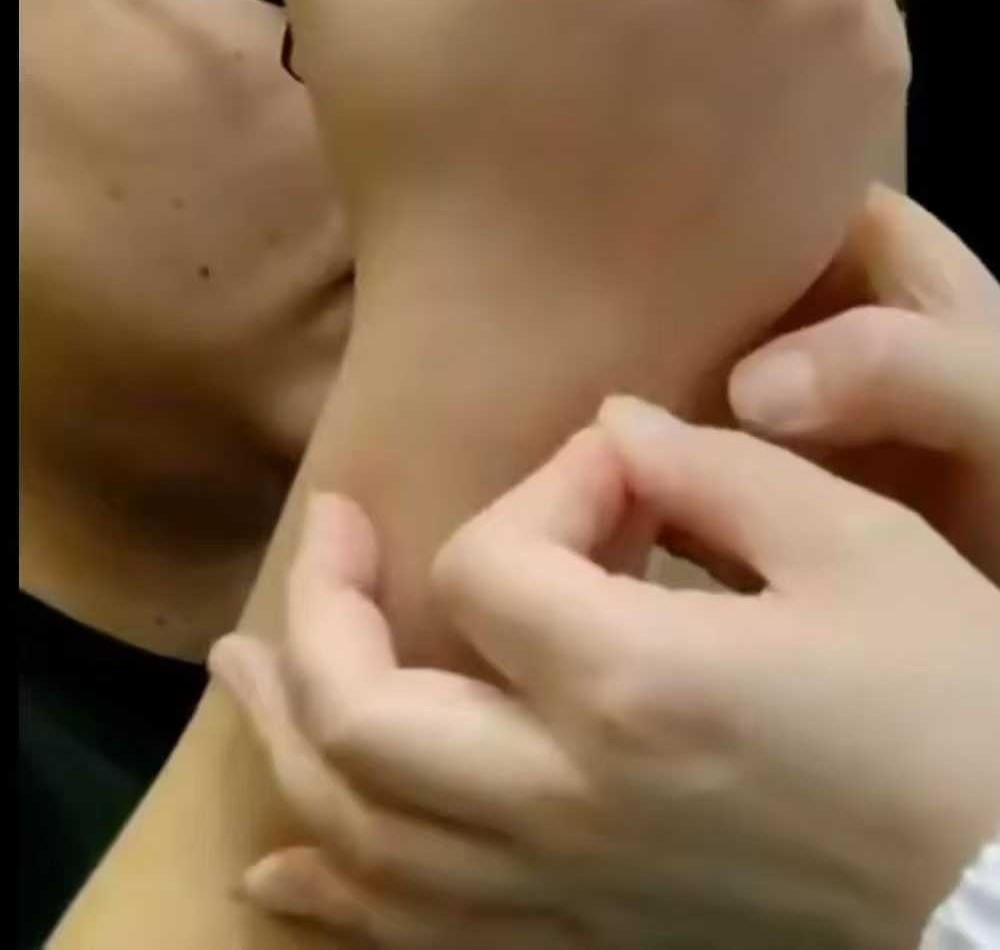 李小红皮内针疗法教程长安中医学派精品班网课合集针灸视频自学课