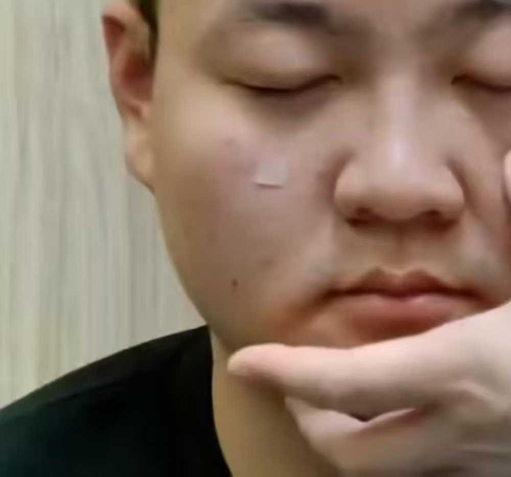李小红皮内针疗法教程长安中医学派精品班网课合集针灸视频自学课