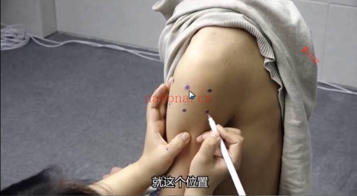吴春梅董氏奇穴28集视频 中医针灸