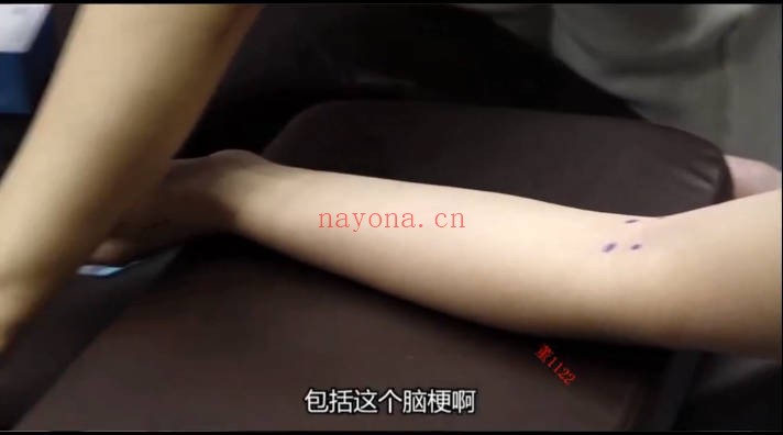 吴春梅董氏奇穴28集视频 中医针灸