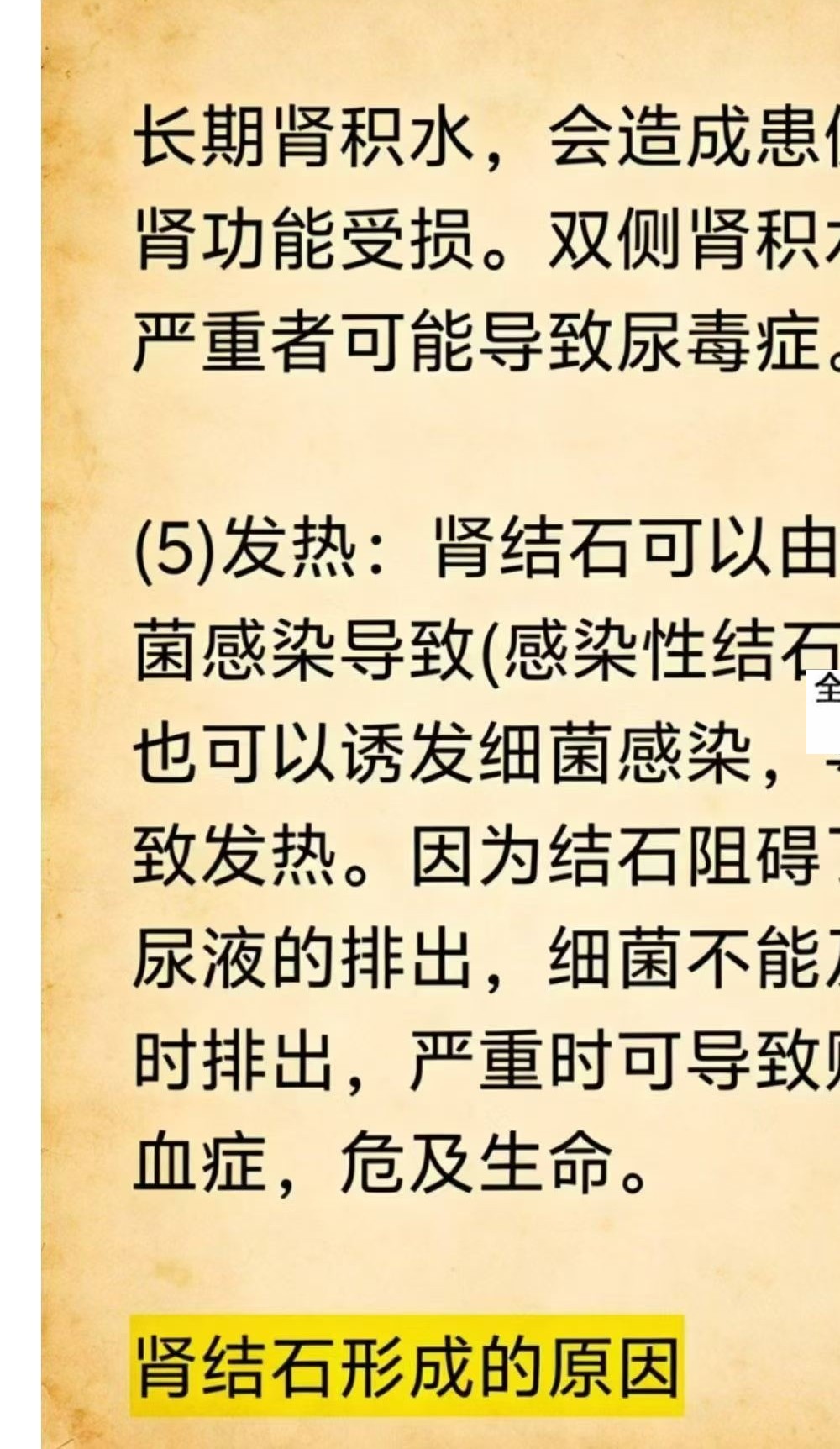 《民间结石特效方》52页