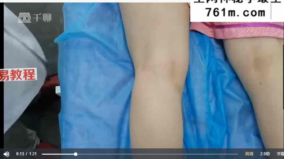 百年手法一招治疼痛康复技术课程 视频82集