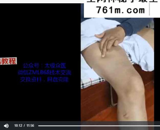 包医鼻炎点穴绝技+包医鼻炎药油配方