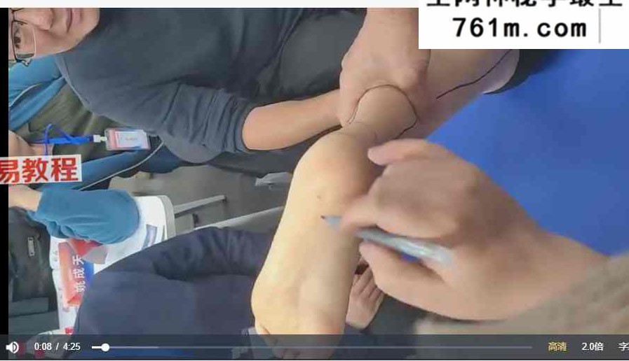 仇永峰一针镇痛技术 视频48集+文字图片