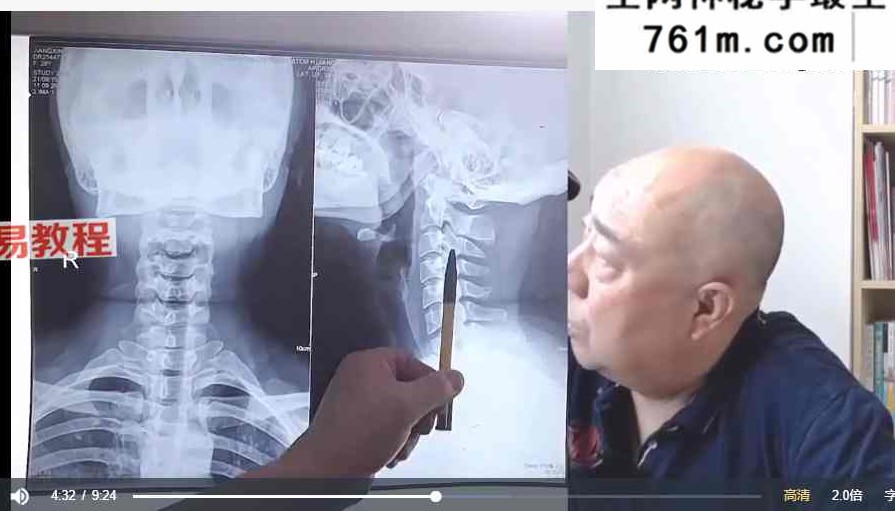 彭老亲传摸gu诊痛脊柱全息手感诊断法 视频37集