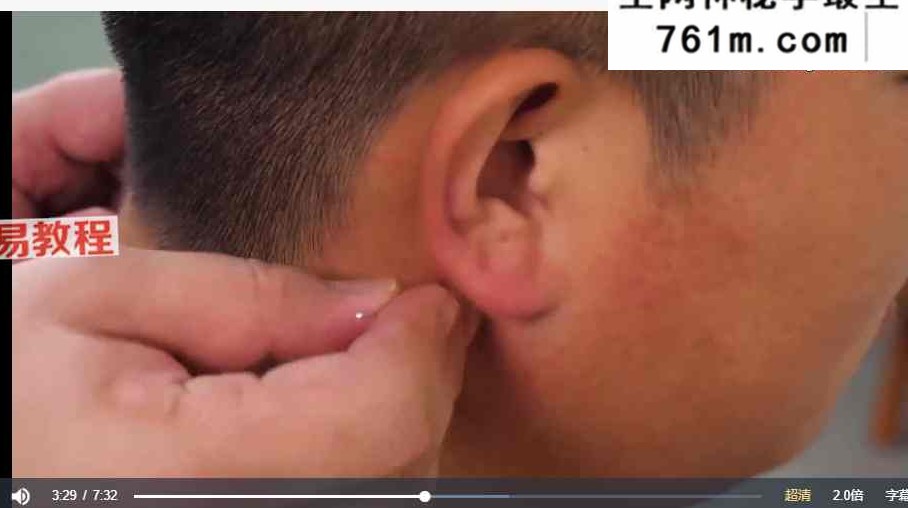 醒脑开窍针刺法治疗5种中风后遗症——薛晏 视频9集