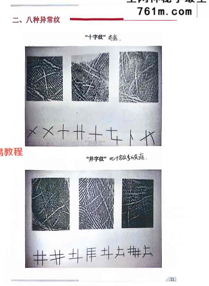 综合望诊 pdf 两册 共150页