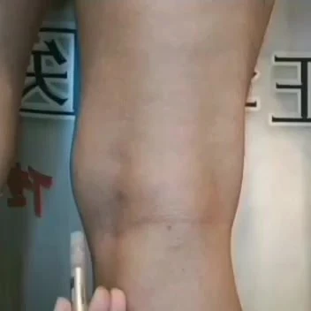 《神奇的古老中医绝技一个穴位一根针高血脂高血压风湿中医针灸视频》
