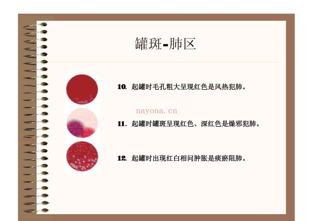 《罐诊》拔罐内部学习资料9