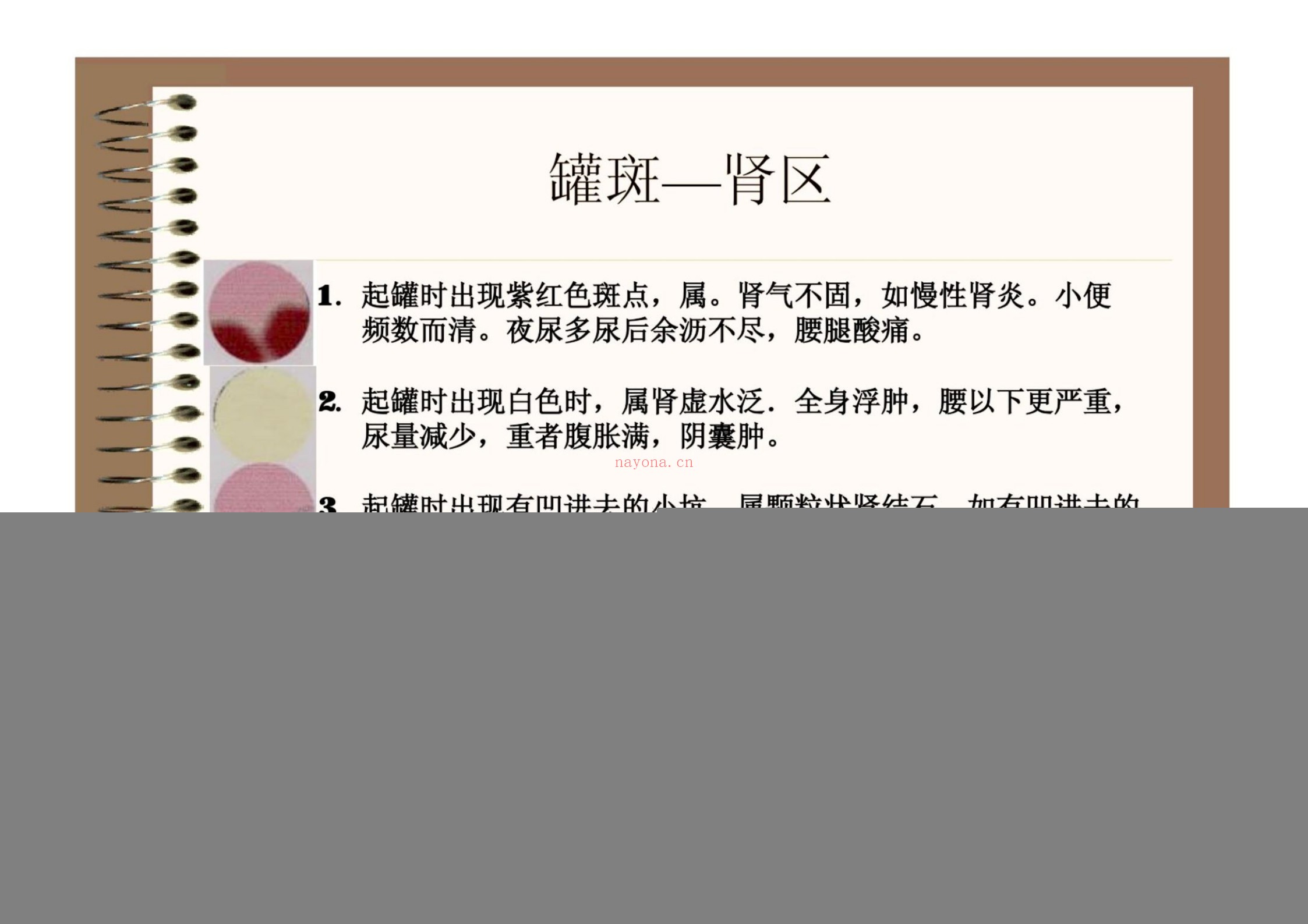 罐诊