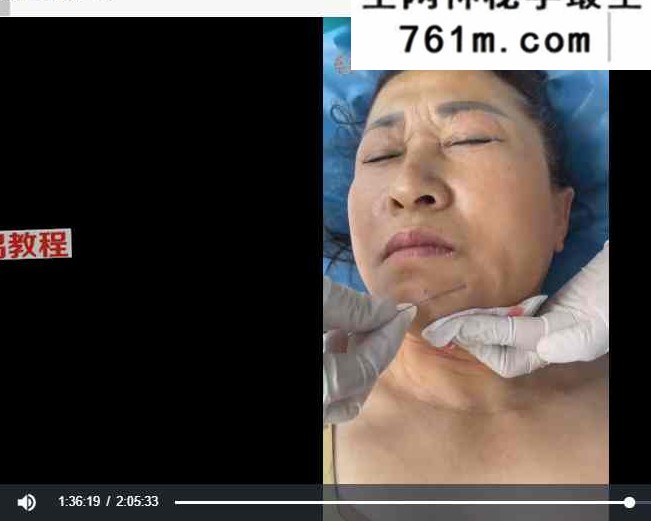 孙星云桃花一针课程视频3集