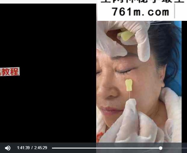 孙星云桃花一针课程视频3集