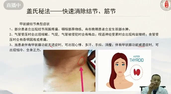 《刘志成盖氏秘传消结术》视频11集