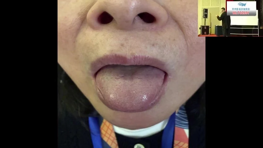 《神农舌象通调术线下课于化春第一期》视频11集
