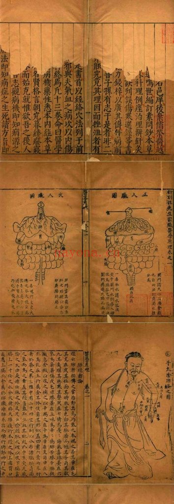 新刻汪先生家藏医学原理(页面有部分残缺).十三卷.明.汪机编辑.明代吴继武.谢孜刊本