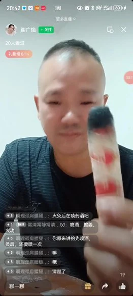 《龙氏祖传三代民间火灸疗法》视频2集
