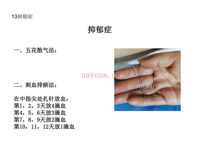 道家六元神针学习笔记55页PDF 道医针法