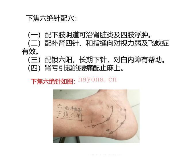 道家六元神针学习笔记55页PDF 道医针法