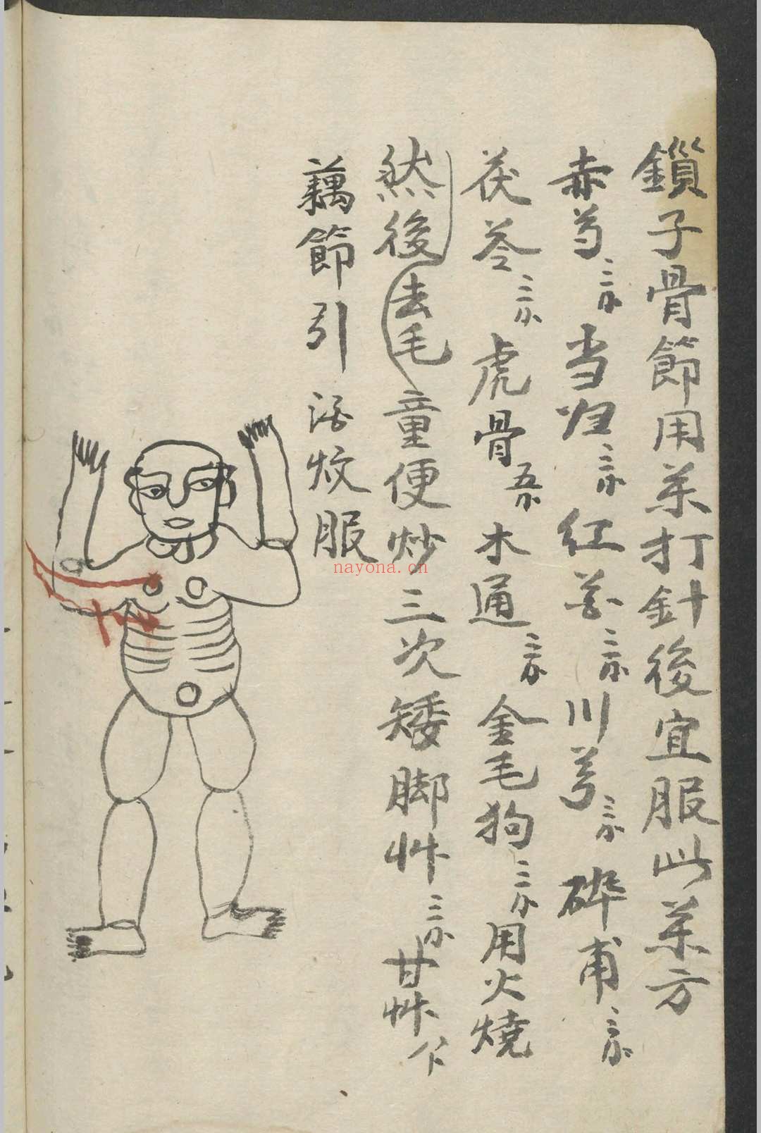 跌打损伤 1900